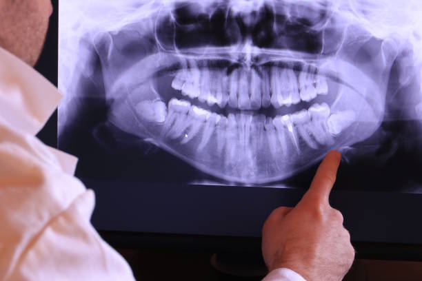 Best Emergency Dental Care for Broken or Chipped Teeth in Peabody, KS